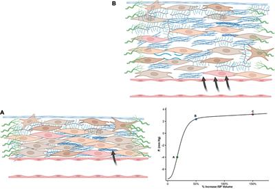 The interstitial compartment as a therapeutic target in heart failure